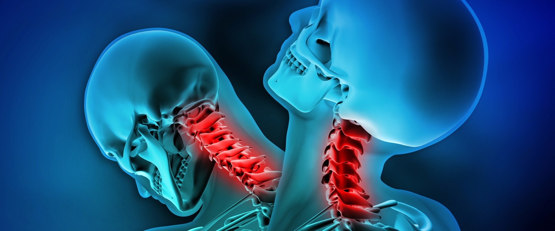 Chiropractic Care for Whiplash Injury: An Expert's Perspective